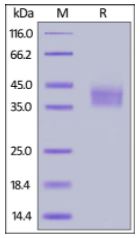 Mouse B7-H3, His Tag on SDS-PAGE under reducing (R) condition. The gel was stained overnight with Coomassie Blue. The purity of the protein is greater than 95%.